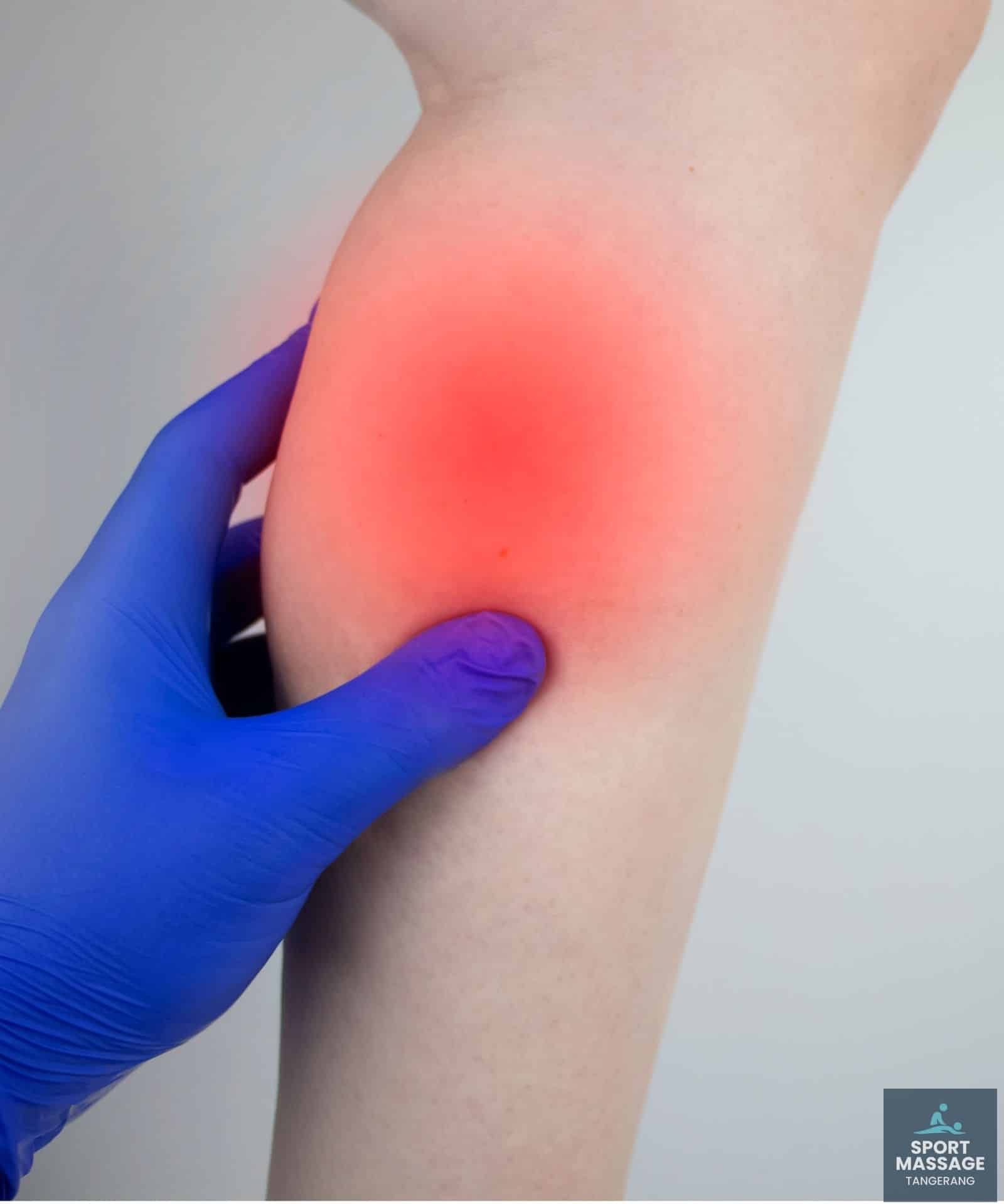 Terapi Cedera Otot Betis (Calf Strain)